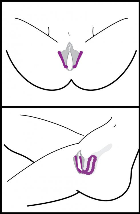Oral Assisting Labia Spreader Image 4