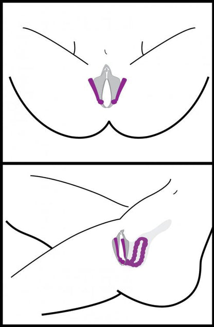 Oral Assisting Labia Spreader Image 4